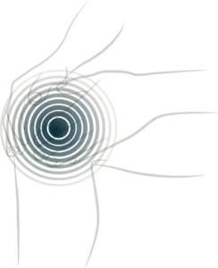 Jo_Clingan_Sportsmassage_Rebalance_knae_smerter